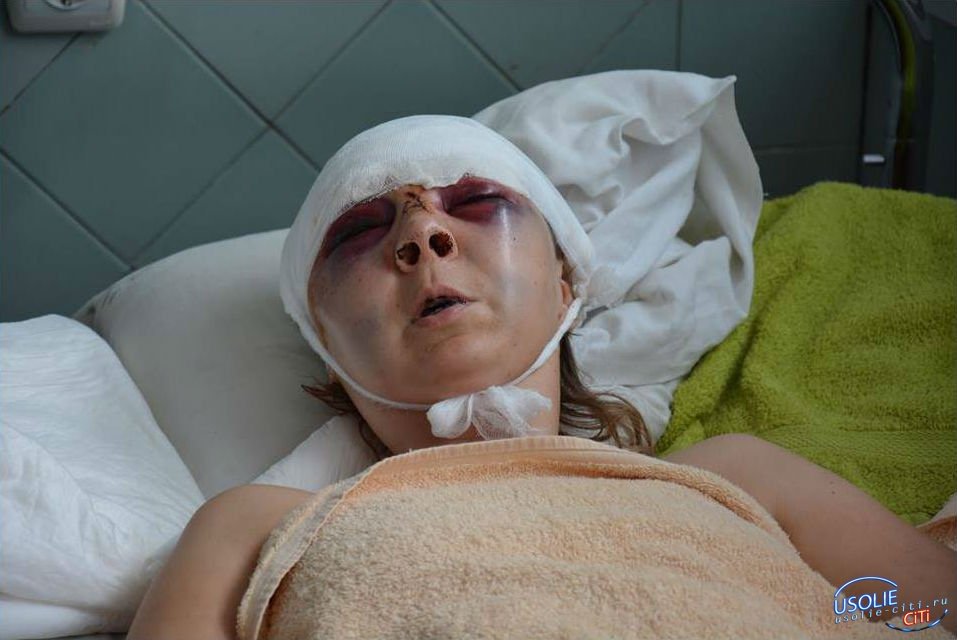 Из-за ревности: Жительница Мишелевки  стеклянной бутылкой разбила лицо своей сопернице
